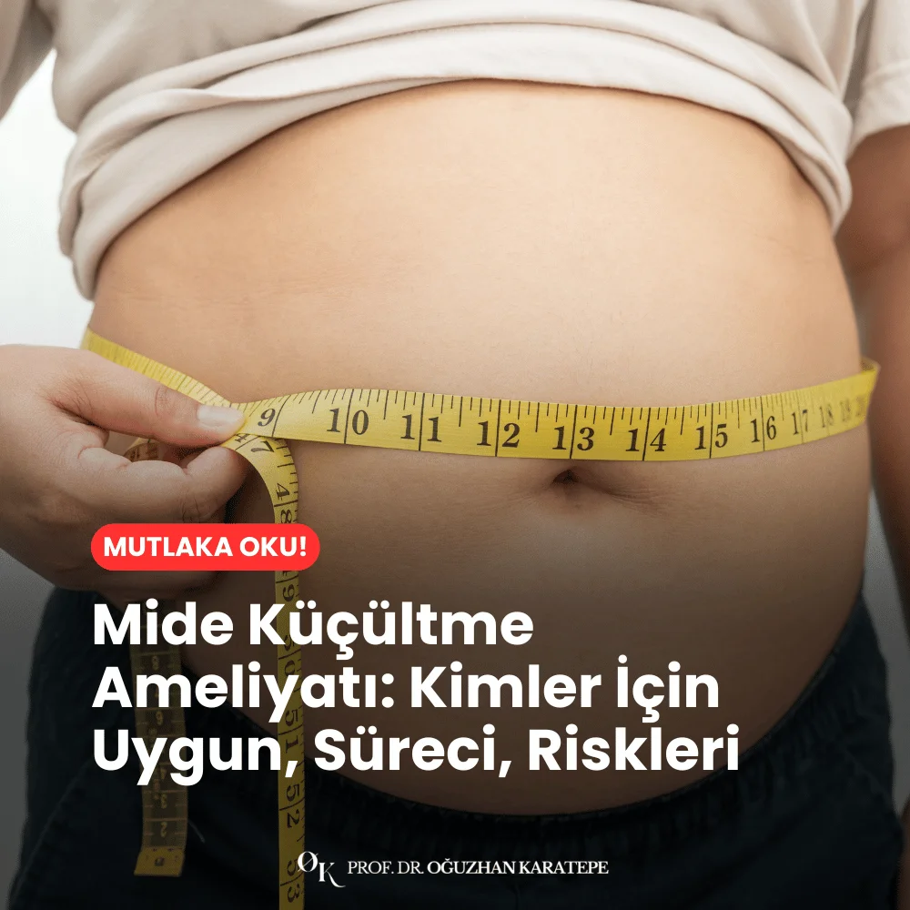 Mide Küçültme Ameliyatı Kimler İçin Uygun, Süreci, Riskleri