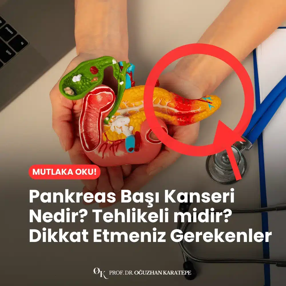 Pankreas Başı Kanseri Nedir? Tehlikeli midir? Dikkat Etmeniz Gerekenler Neler