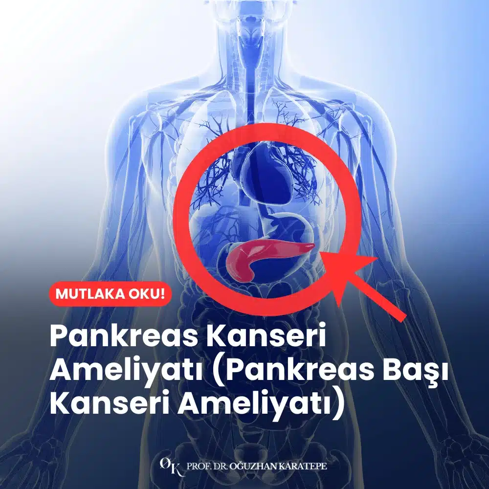 Pankreas Kanseri Ameliyatı (Pankreas Başı Kanseri Ameliyatı) Nedir