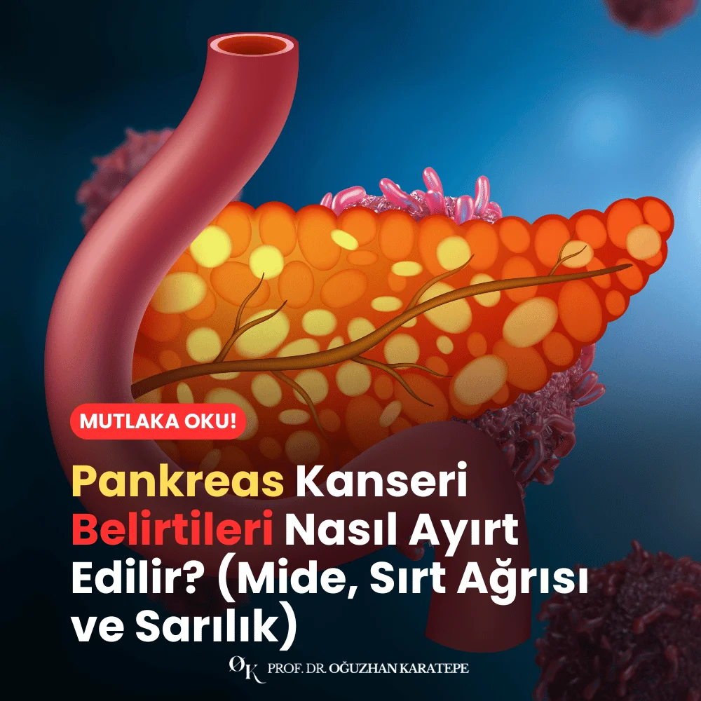 Pankreas Kanseri Belirtileri Nasıl Ayırt Edilir? (Mide, Sırt Ağrısı ve Sarılık) Neler