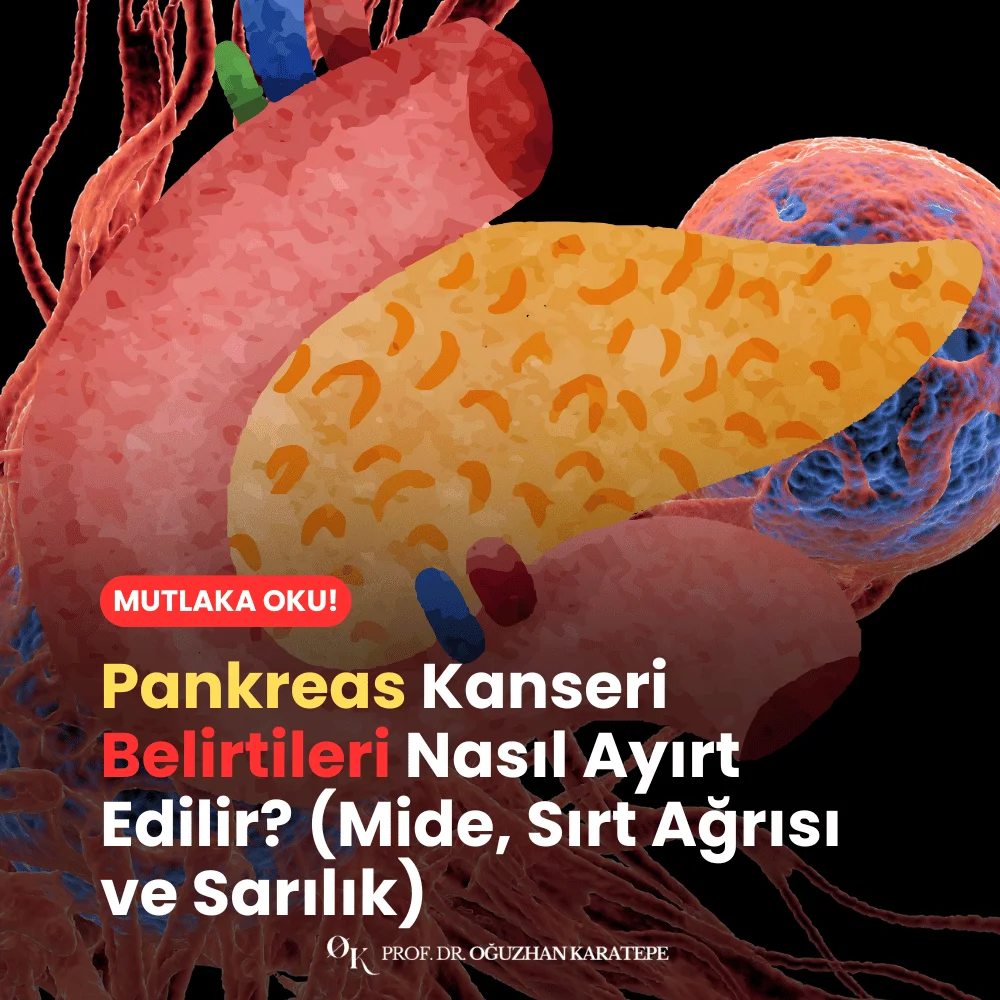 Pankreas Kanseri Belirtileri Nasıl Ayırt Edilir? (Mide, Sırt Ağrısı ve Sarılık)