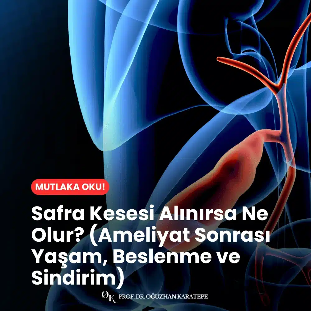 Safra Kesesi Alınırsa Ne Olur? (Ameliyat Sonrası Yaşam, Beslenme ve Sindirim) Nedir