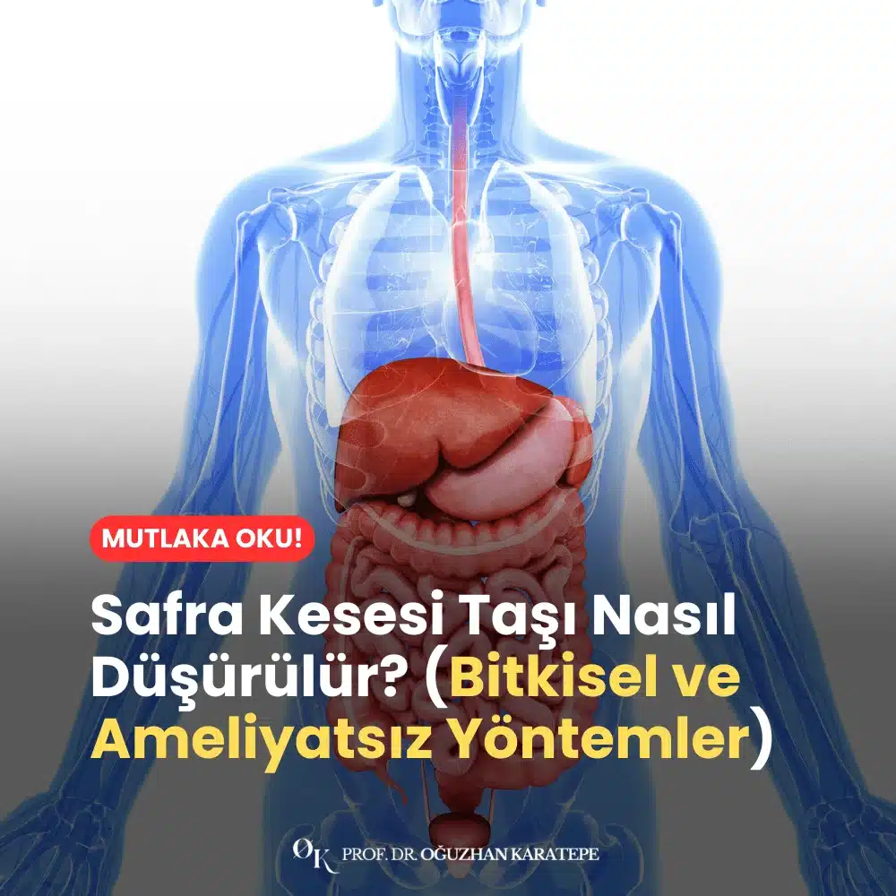 Safra Kesesi Taşı Nasıl Düşürülür? (Bitkisel ve Ameliyatsız Yöntemler)