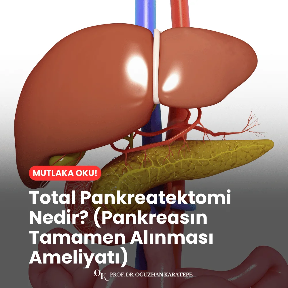 Total Pankreatektomi Nedir? (Pankreasın Tamamen Alınması Ameliyatı)