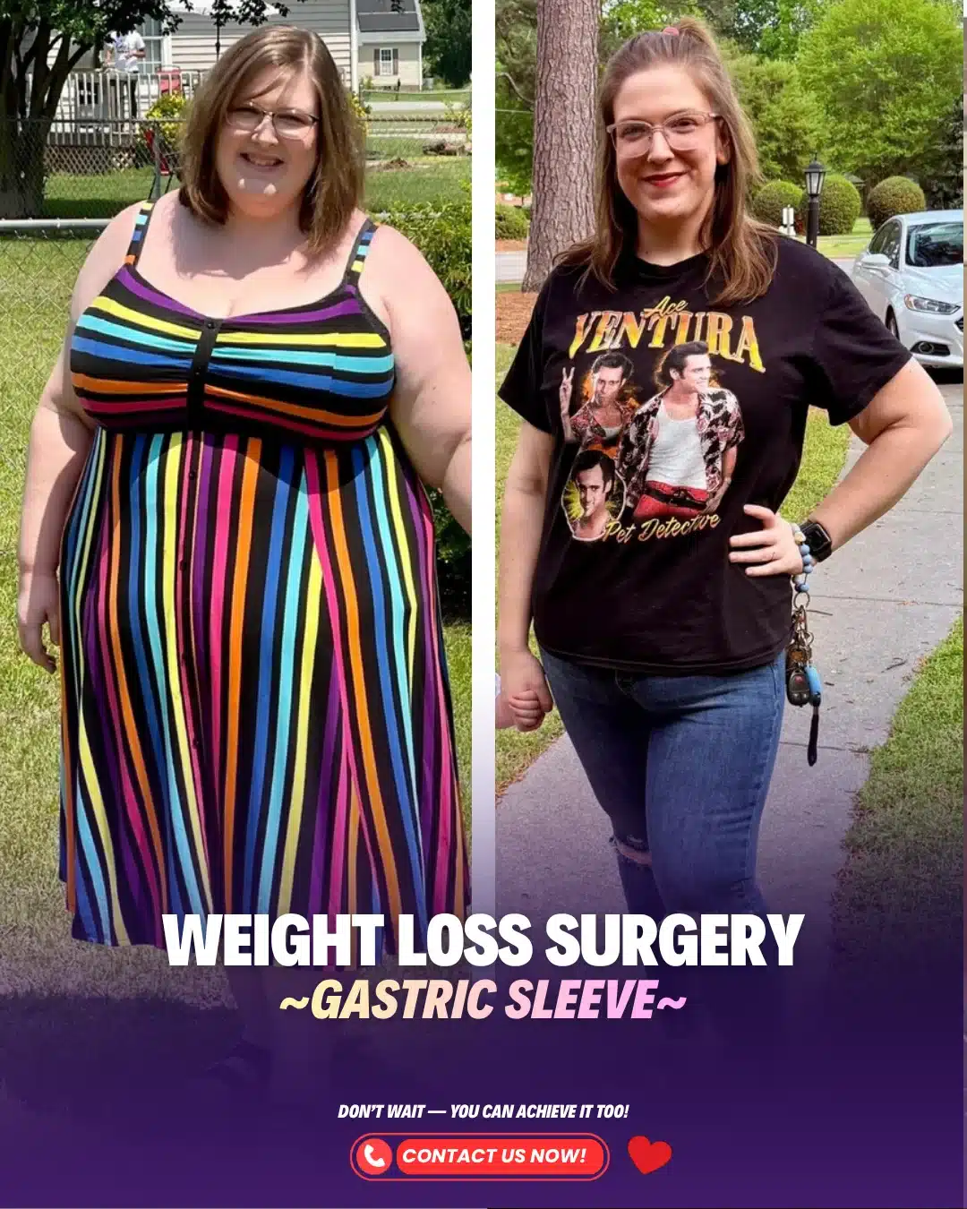 Turkey Weight Loss Bariatric Gastric Sleeve Surgery