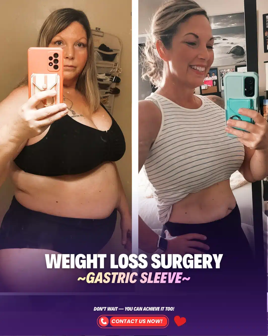 Best Bariatric Surgeon Turkey