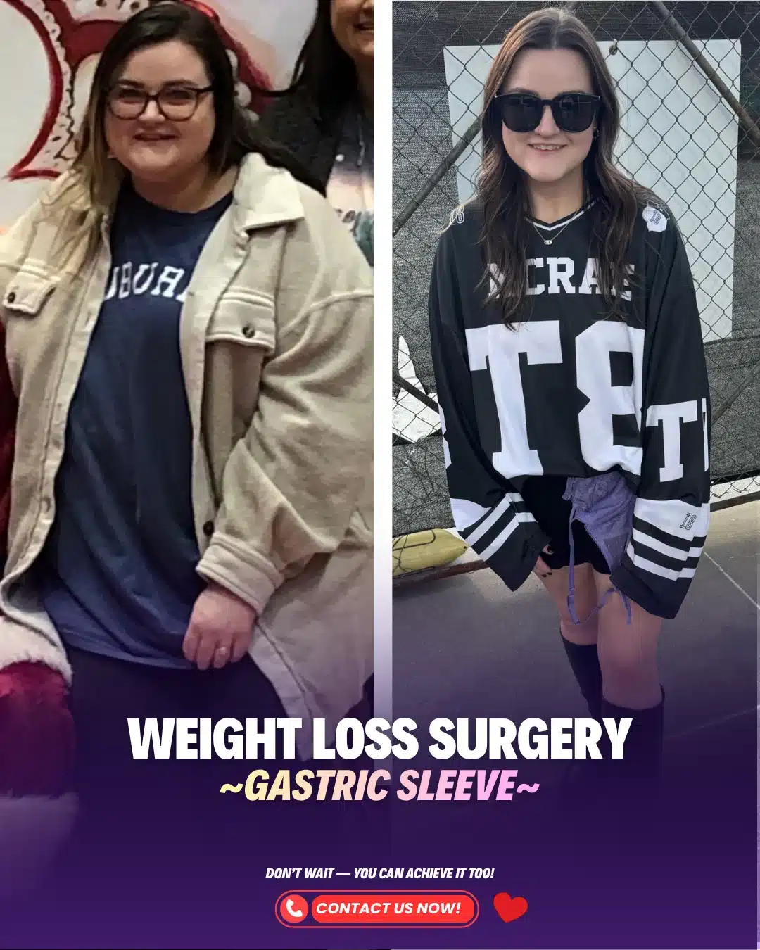 Best Bariatric Surgery Turkey