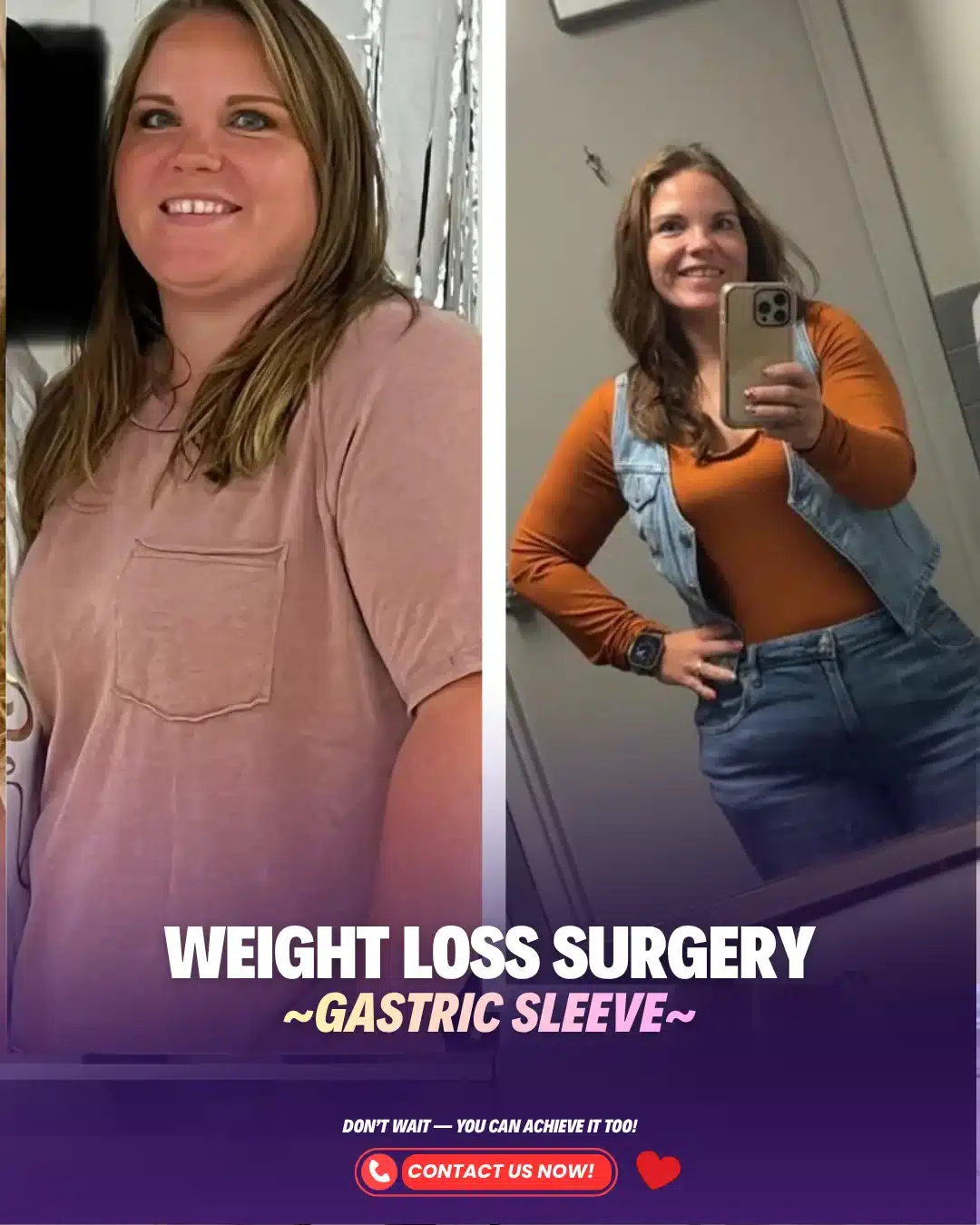 Best Bariatric Surgeon Turkey