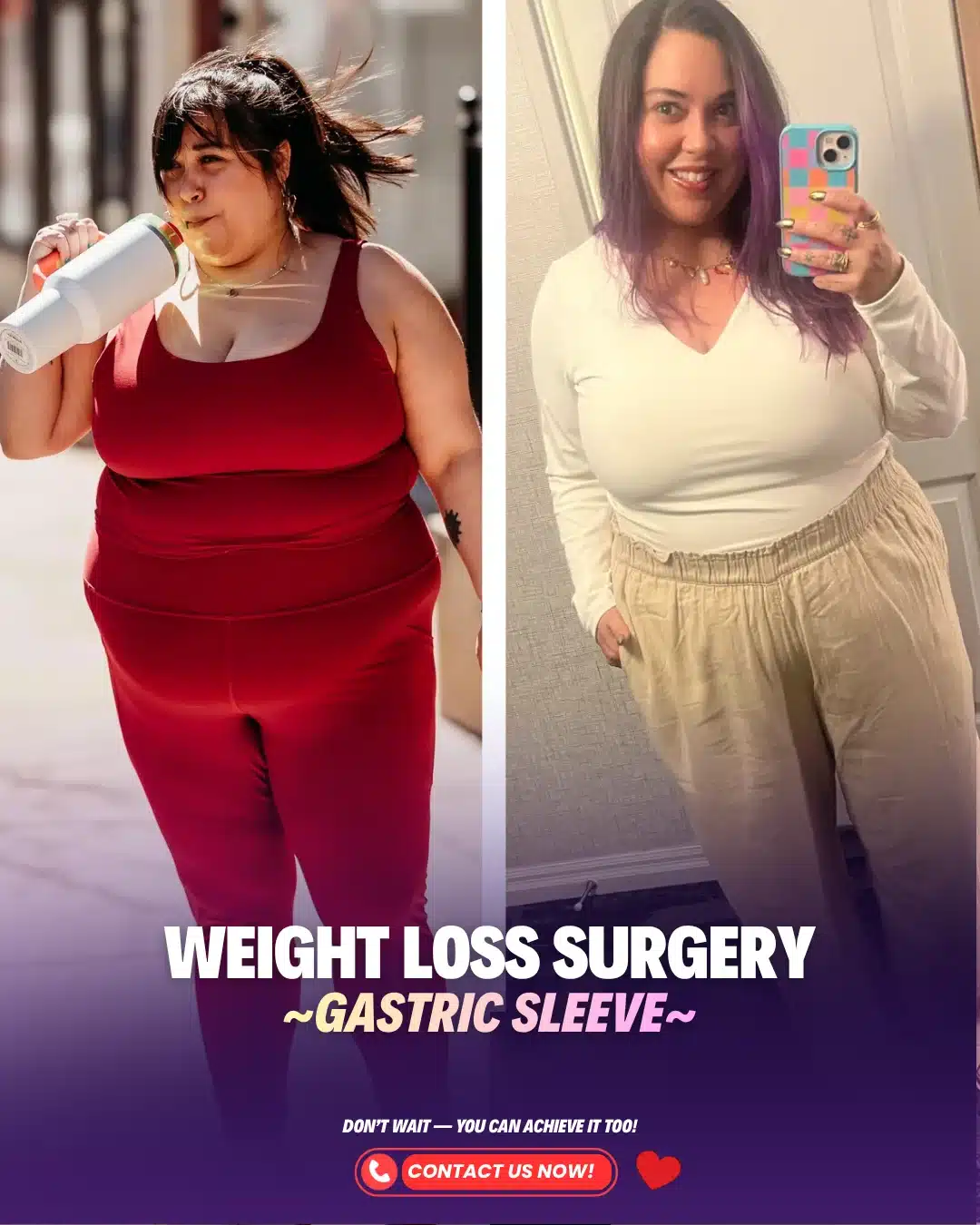 Best Bariatric Surgeon Turkey