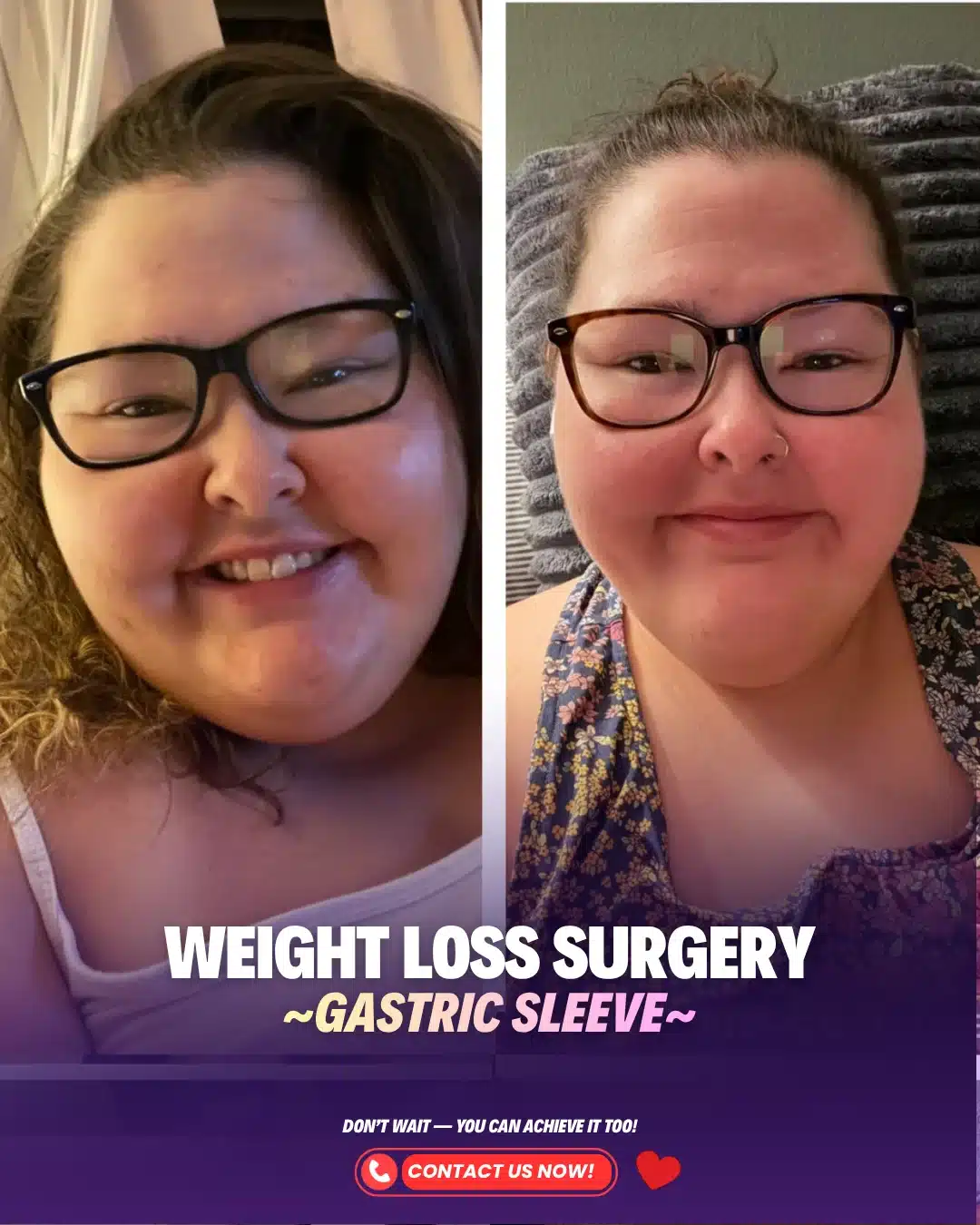 Best Bariatric Surgery Turkey