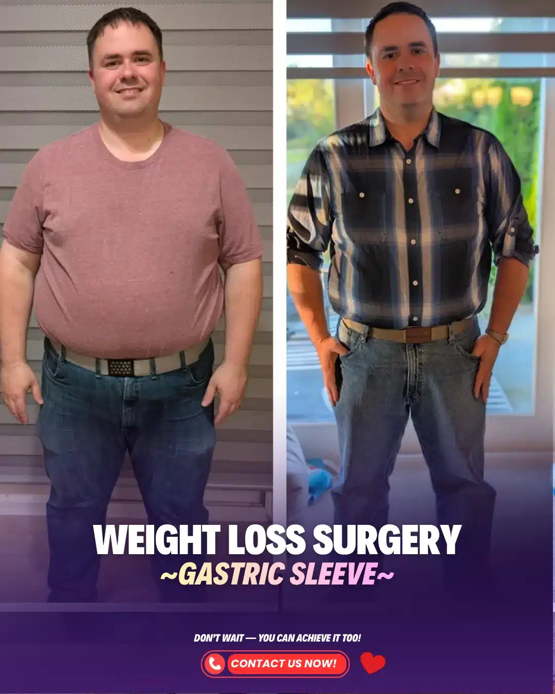 Bariatric Surgery Turkey Before After