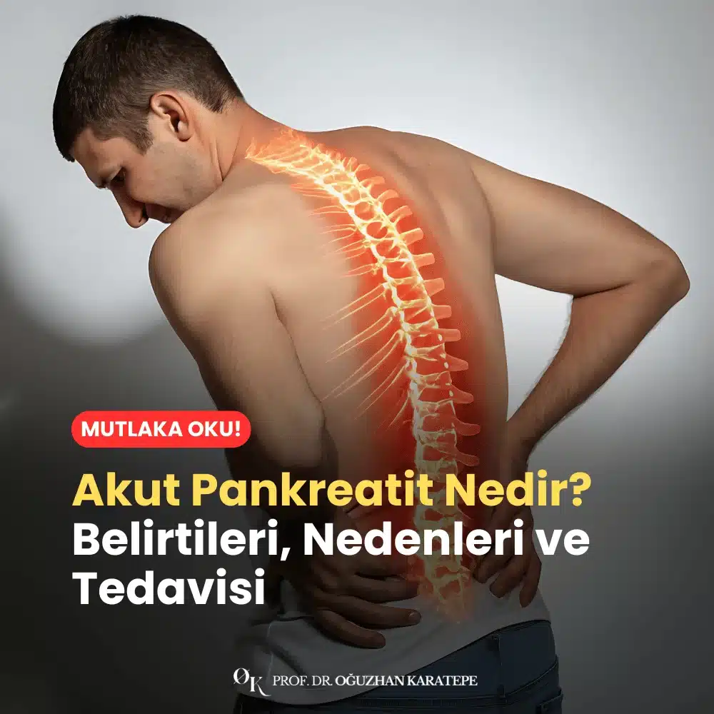 Akut Pankreatit Nedir