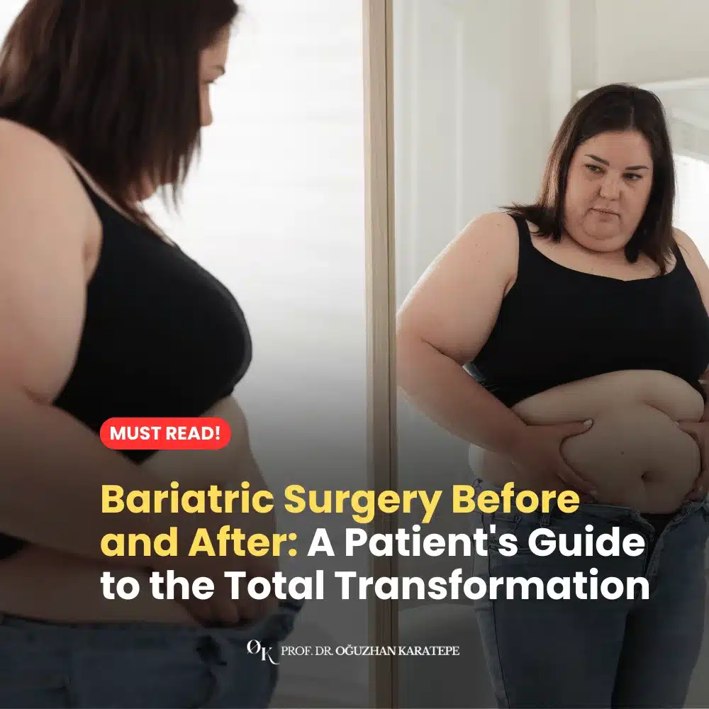 Bariatric Surgery Before and After