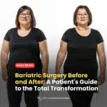 Bariatric Surgery Before and After