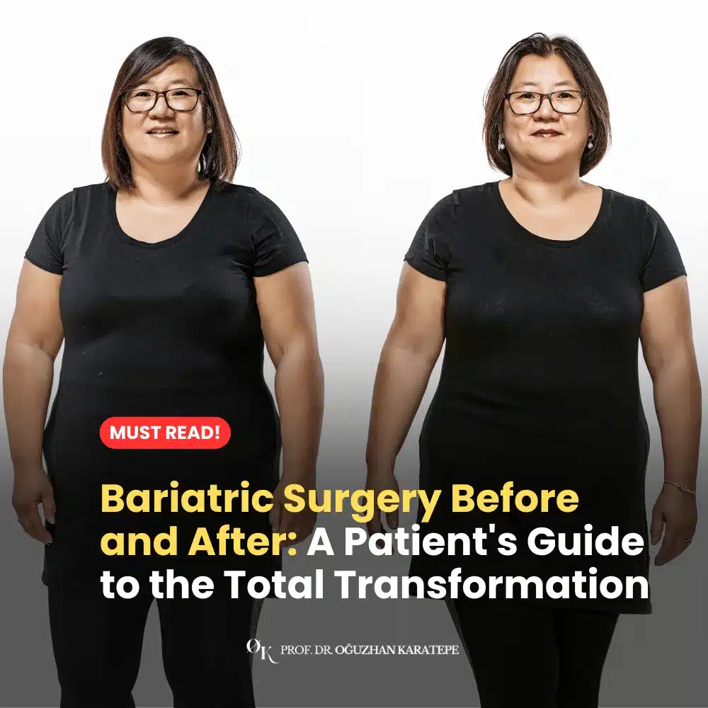 Bariatric Surgery Before and After