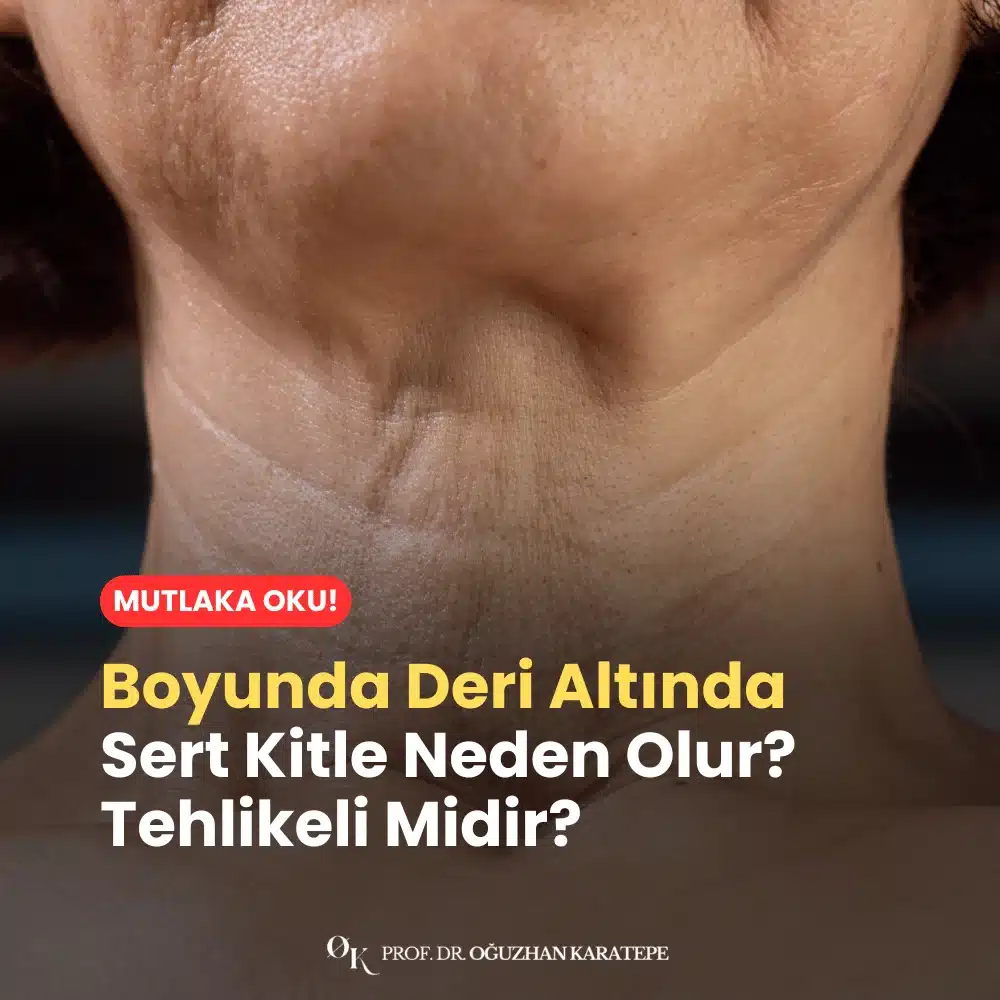 Boyunda Deri Altında Sert Kitle Neden Olur