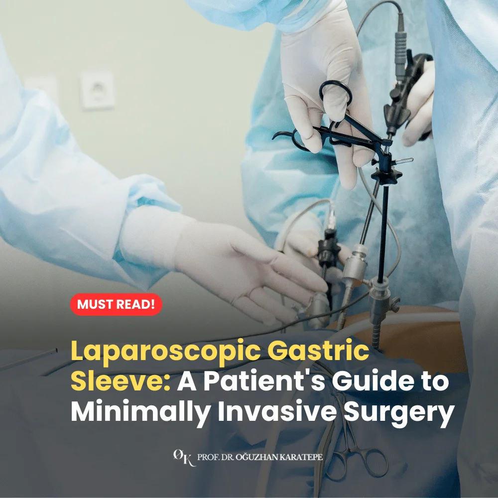 Laparoscopic Gastric Sleeve