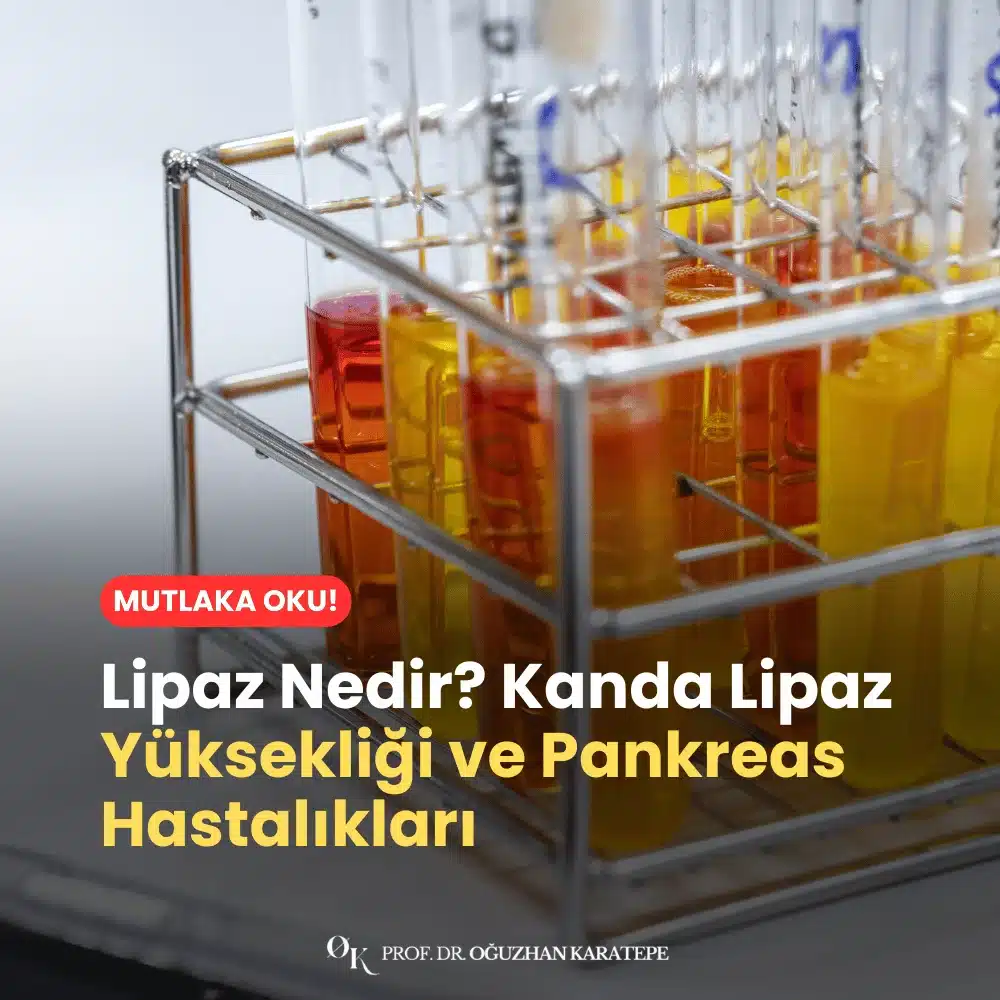 Lipaz Nedir? Kanda Lipaz Yüksekliği ve Pankreas Hastalıkları Nedir