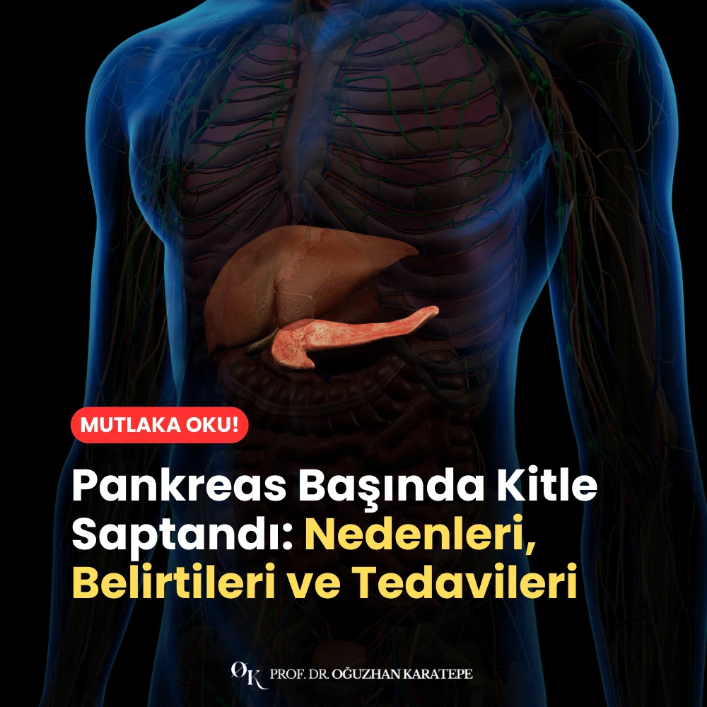 Pankreas Başında Kitle Saptandı Nedenleri, Belirtileri ve Tedavileri