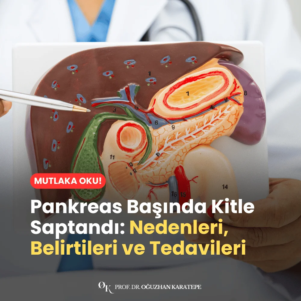 Pankreas Başında Kitle Saptandı Nedenleri, Belirtileri ve Tedavileri