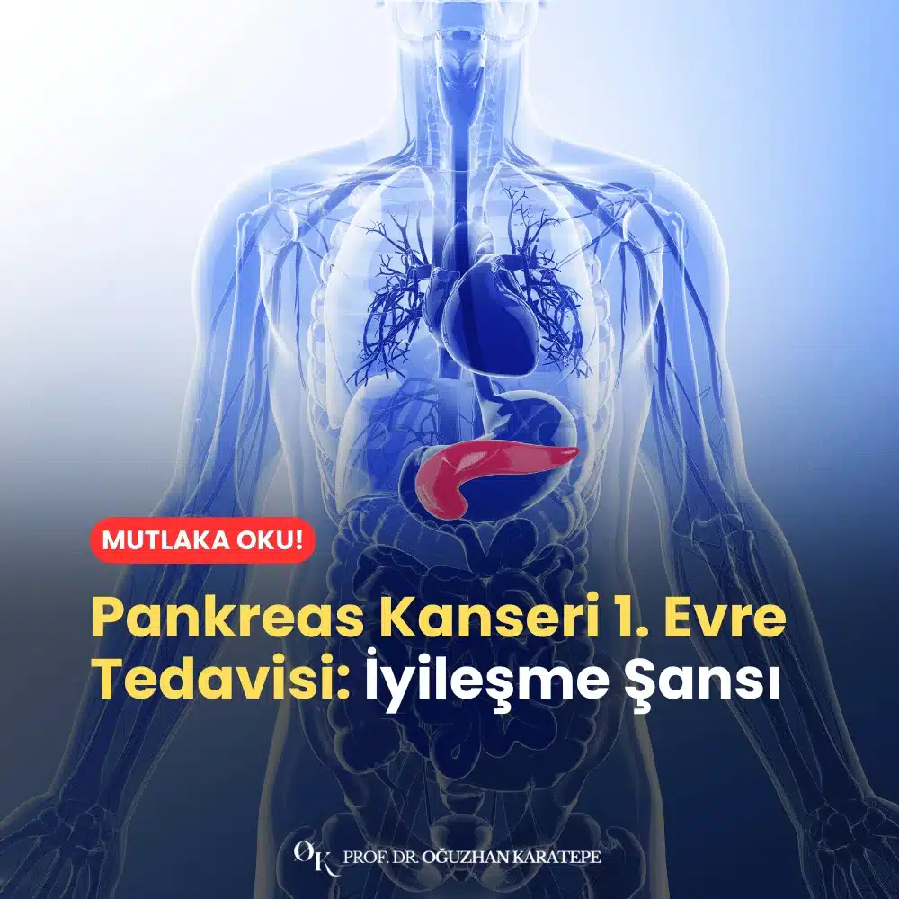 Pankreas Kanseri 1. Evre Tedavisi
