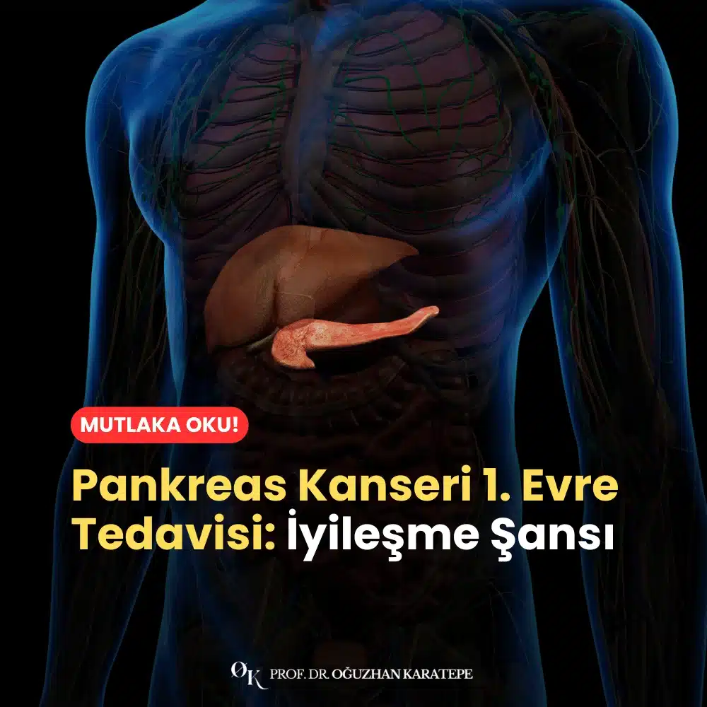 Pankreas Kanseri 1. Evre Tedavisi