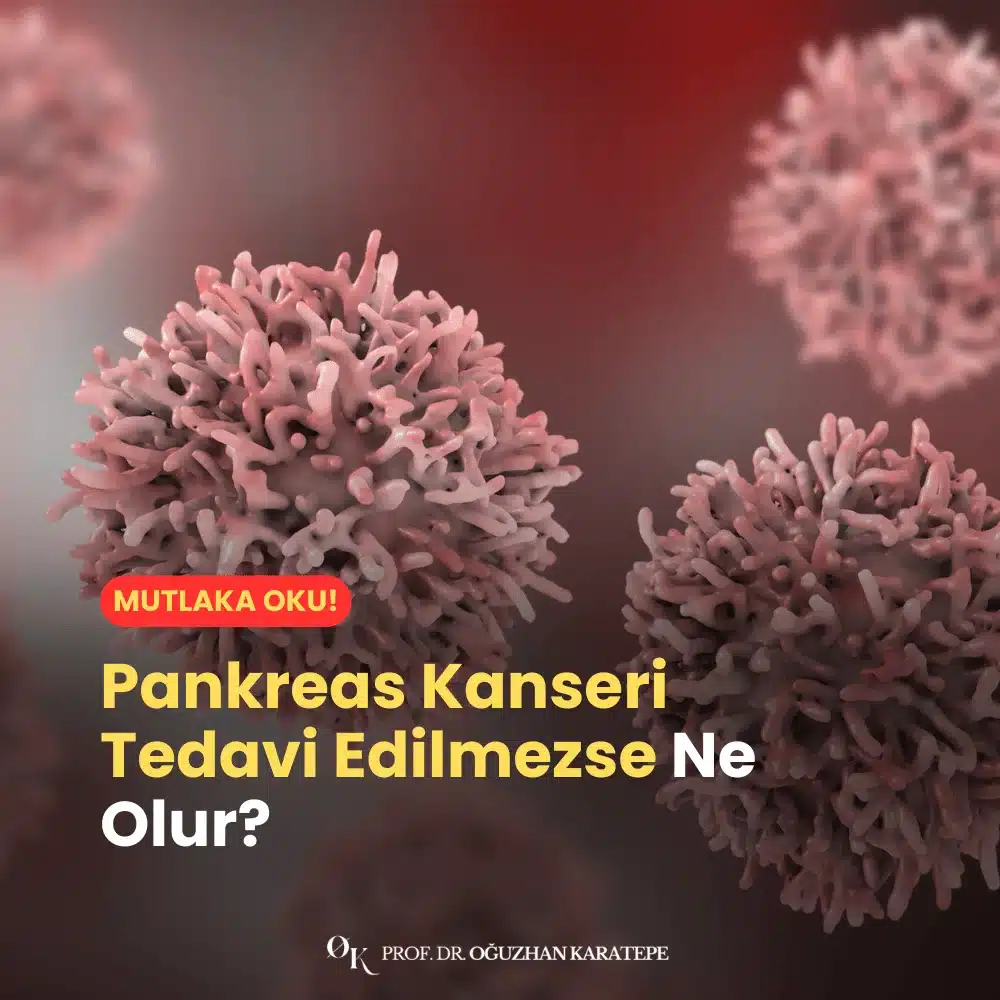 Pankreas Kanseri Tedavi Edilmezse Ne Olur?