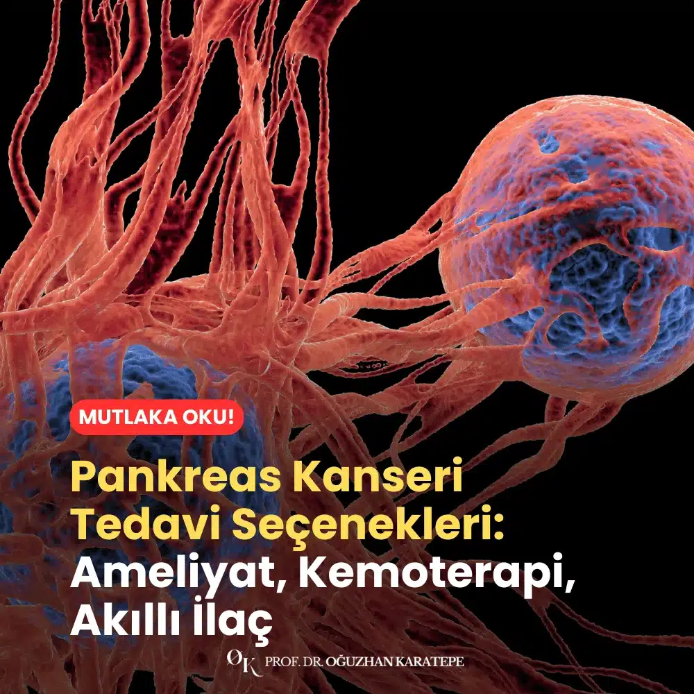 Pankreas Kanseri Tedavi Seçenekleri Ameliyat, Kemoterapi, Akıllı İlaç Nedir