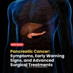 Pancreatic Cancer Symptoms, Early Warning Signs, and Advanced Surgical Treatments
