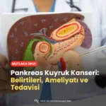 Pankreas Kuyruk Kanseri Belirtileri, Ameliyatı ve Tedavisi