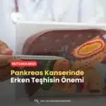 Pankreas Kanserinde Erken Teşhisin Önemi